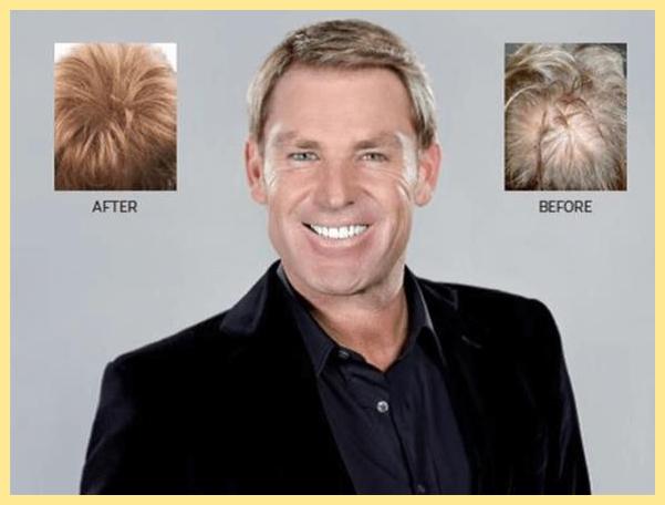 Shane Warne special hair dressing